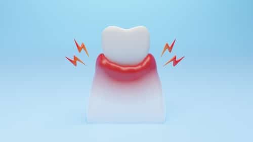 Beverly Hills Periodontist: Gum Disease Has Far-Reaching Consequences
