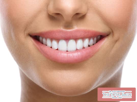 Get a Smile Makeover at the Total Smile