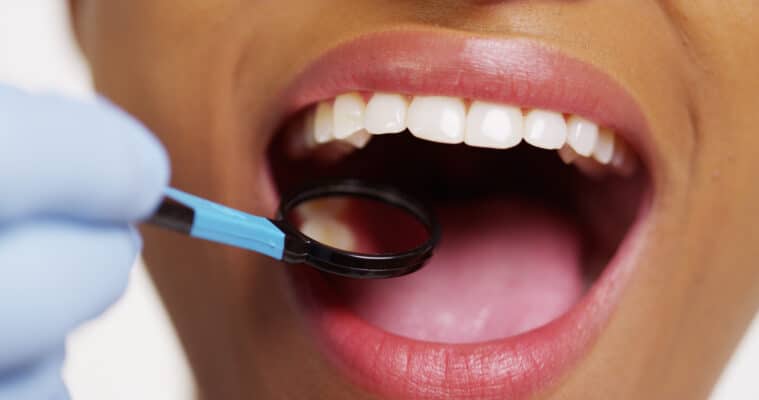 Periodontics in Beverly Hills Gum Disease Treatment
