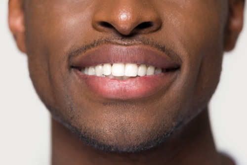 What to Do About Gum Discoloration