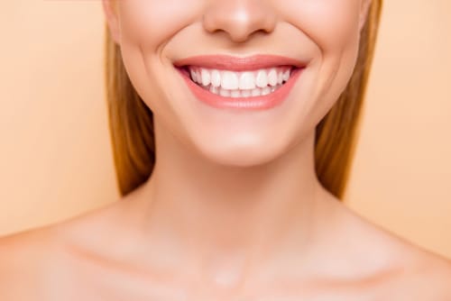 Lip Lowering Treatment for Gummy Smiles Beverly Hills Dentist