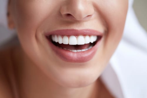 How to Fix Excessive Gum Display Beverly Hills Periodontist Call Us