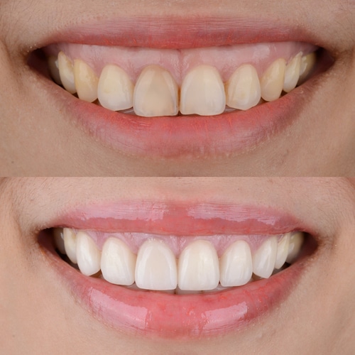 Home The Total Smile Cosmetic Dentistry In Los Angeles